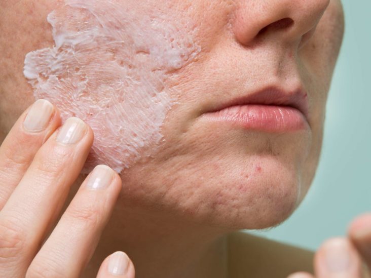 Accutane pilules