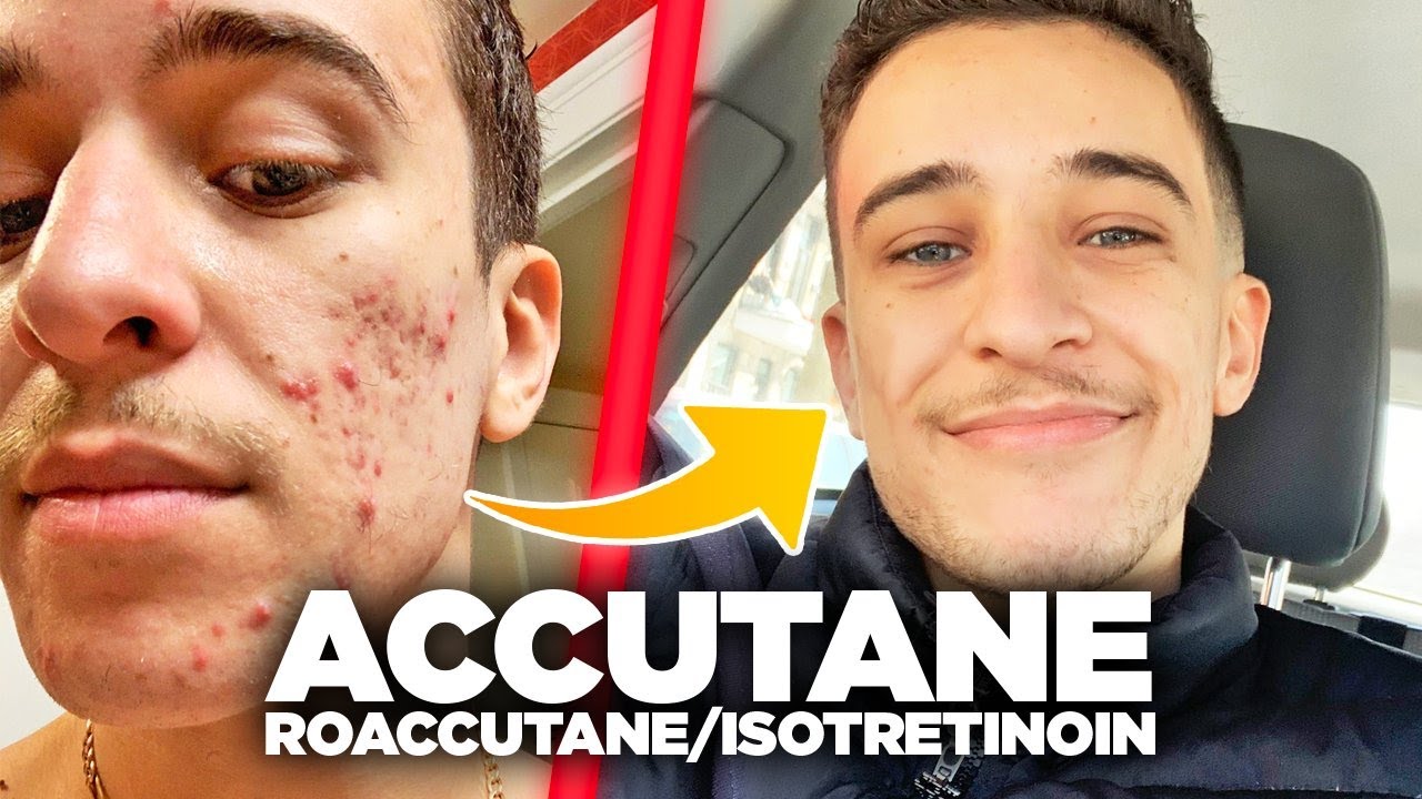 Isotrex achat france Isotrex Achat France