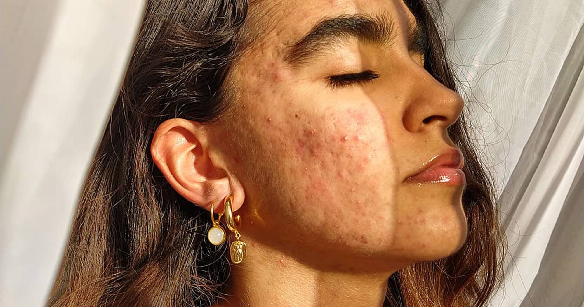 roaccutane 40mg online