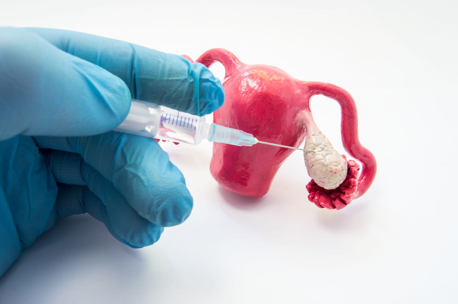 Clomid Sans Ordonnance Jumeaux
