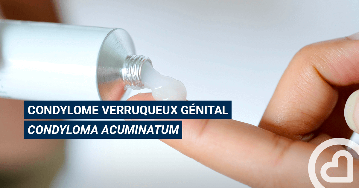 Aldara Acheter Sans Ordonnance