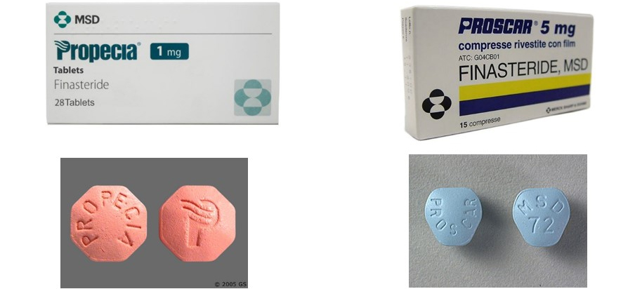 Acheter Finasteride 1 Mg