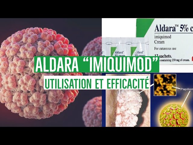 aldara 5 achat en ligne