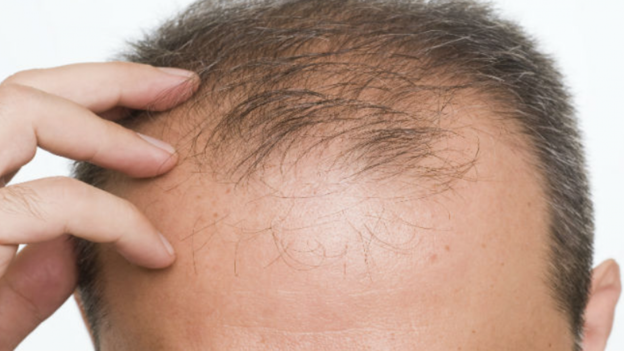 Propecia Cheveux Prix Propecia cheveux prix