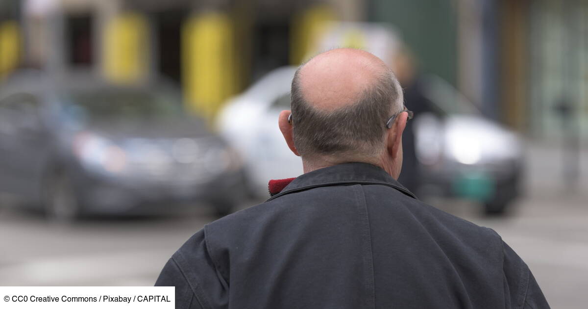 acheter finasteride générique