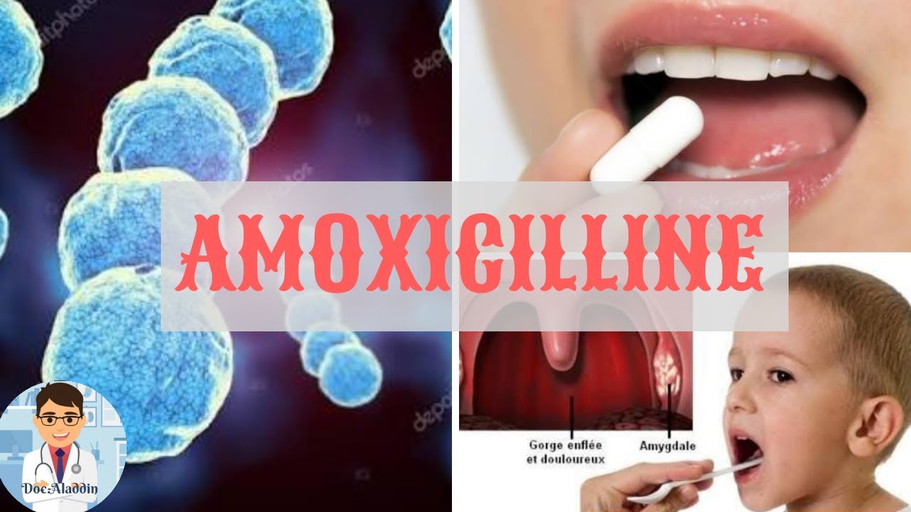 Amoxicilline 1 G Prix