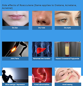 Roaccutane En Ligne Roaccutane En Ligne