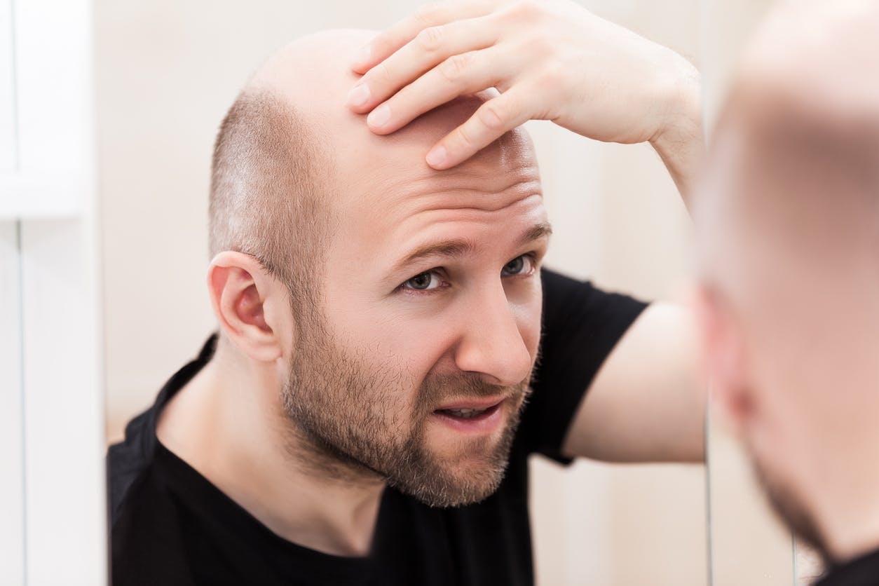 Acheter Finasteride Gel