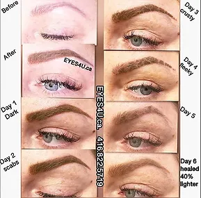 Coût Accutane Coût Accutane
