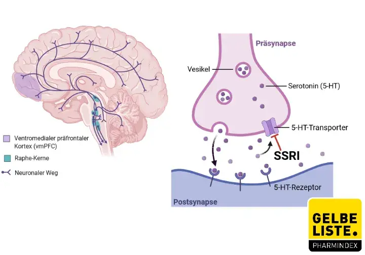 Sertraline 50 mg gélule
