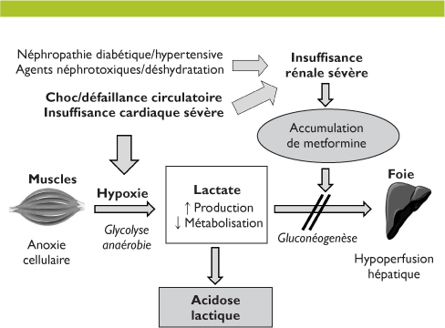 Metformine Le Moins Cher