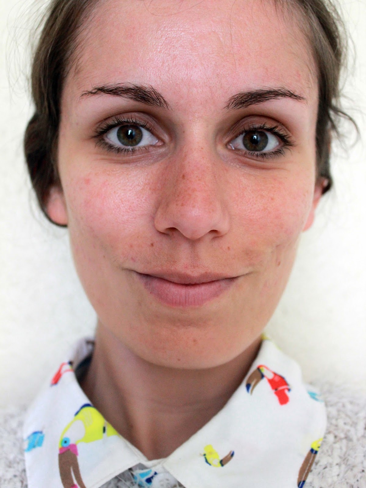 ou acheter du roaccutane