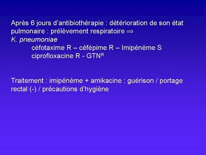 Ciprofloxacin online Ciprofloxacin online