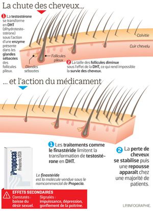 Finasteride bailleul 1 mg prix Finasteride bailleul 1 mg prix