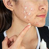 accutane france acheter