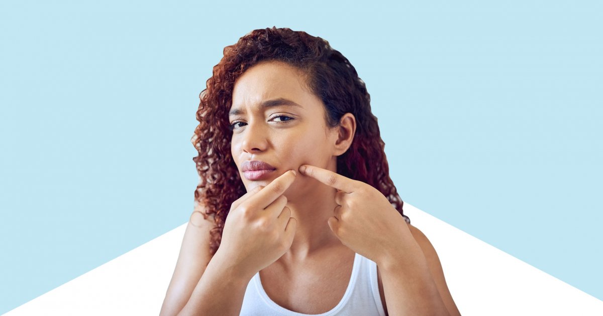 roaccutane gel france