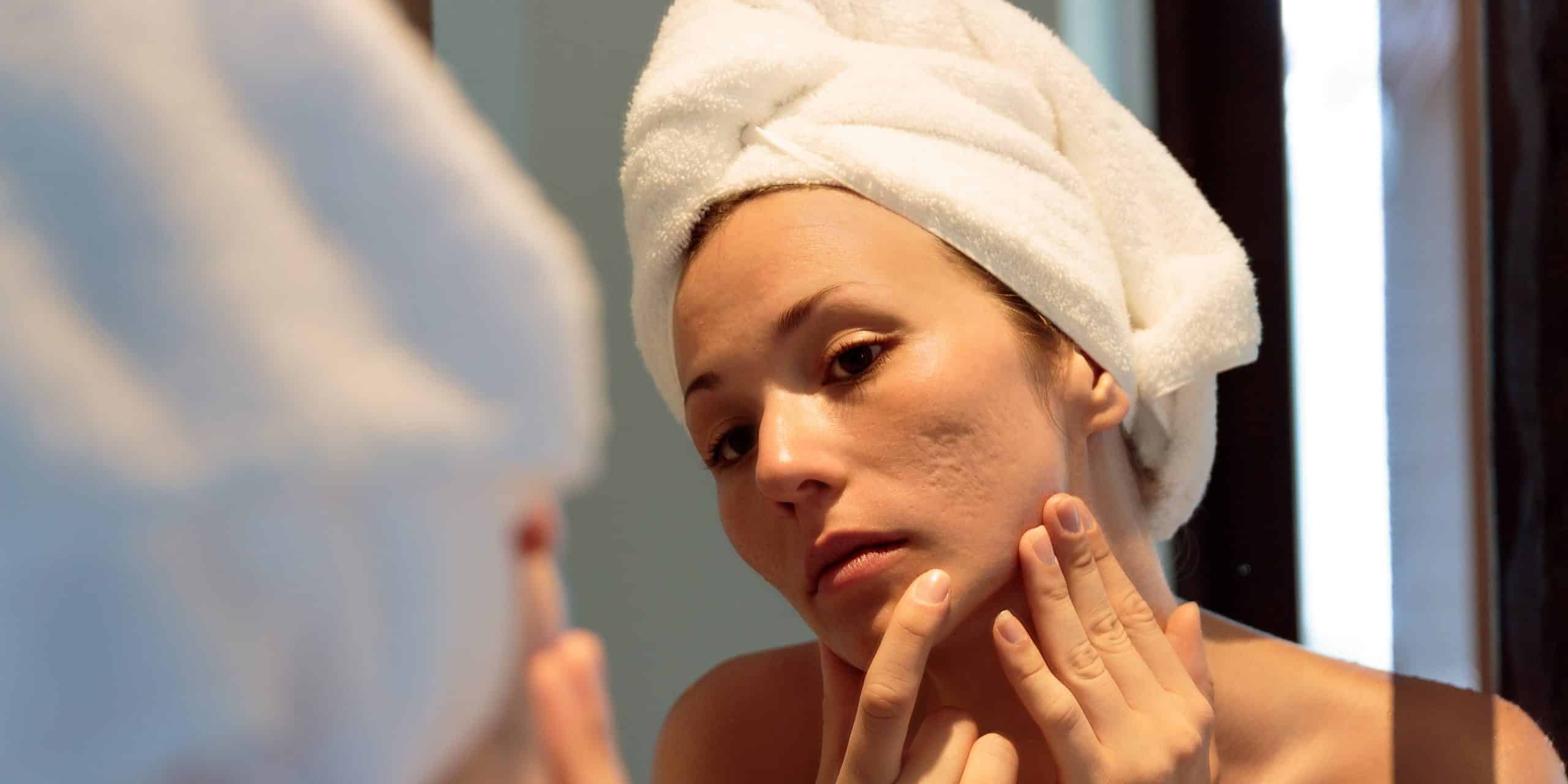 Roaccutane En France