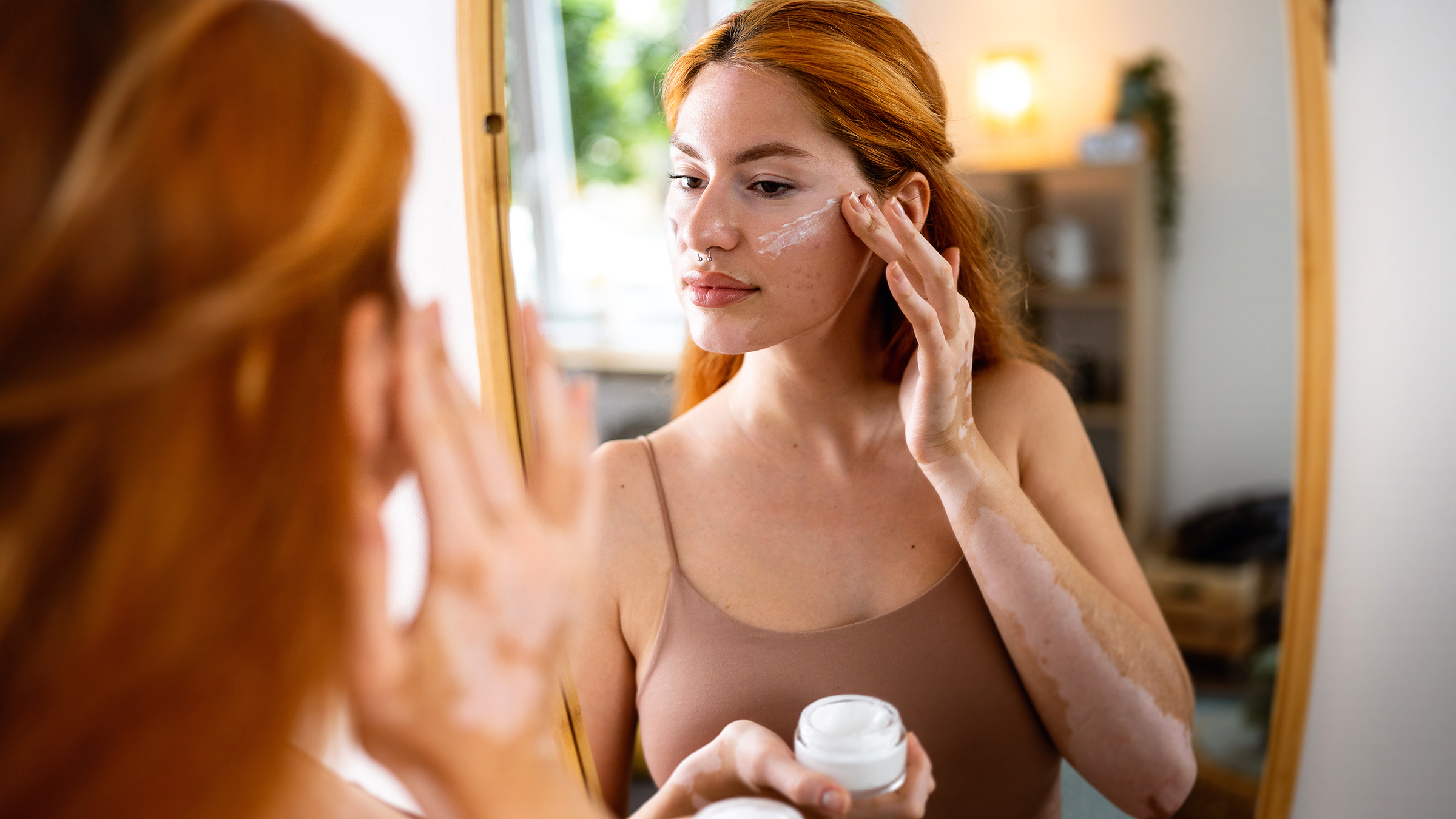 générique de roaccutane