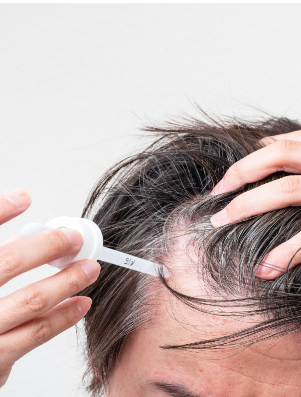 Finasteride Gel France