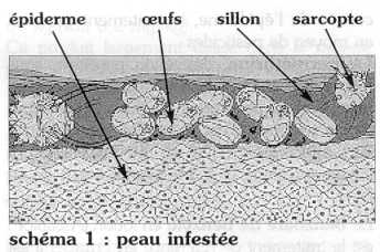 Ivermectine Creme France