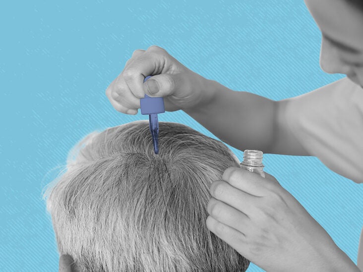finasteride propecia online
