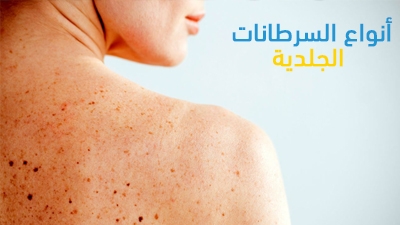 Aldara acheter en ligne aldara acheter en ligne