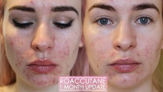 isotretinoin 20mg