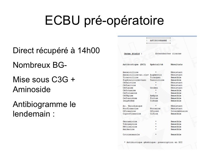 cipro générique