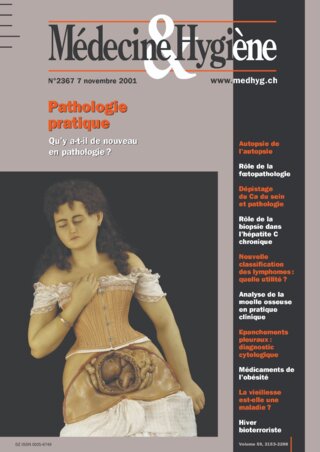 Coût du adipex p