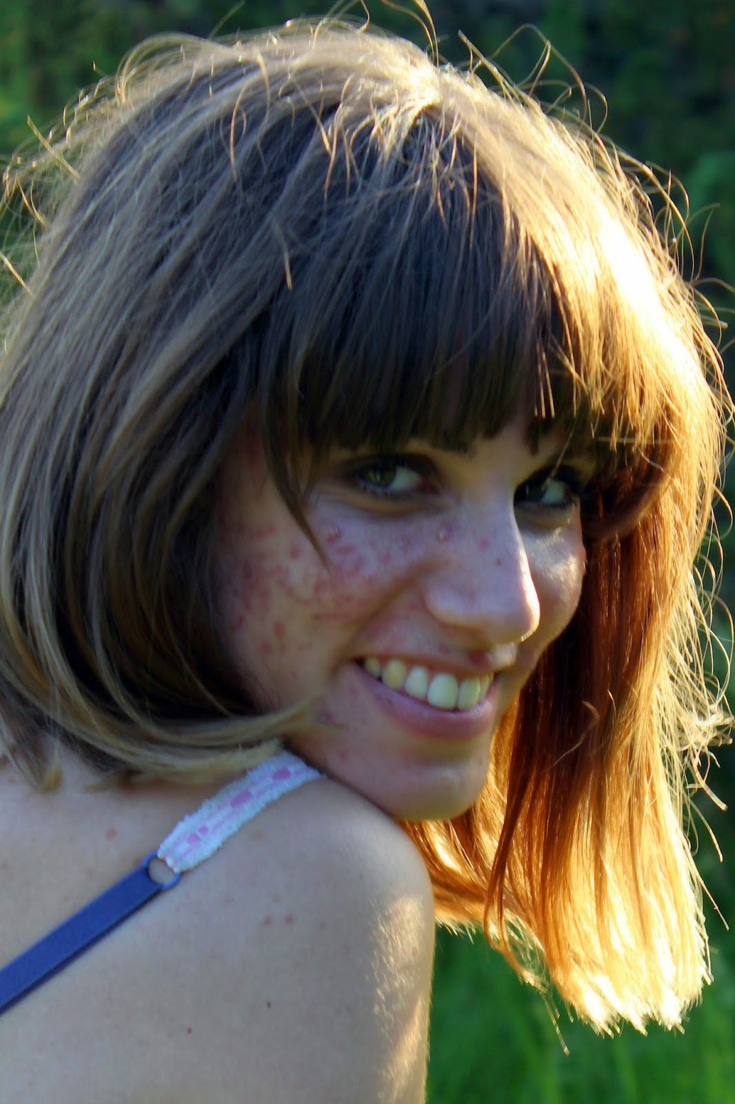 Roaccutane pas cher