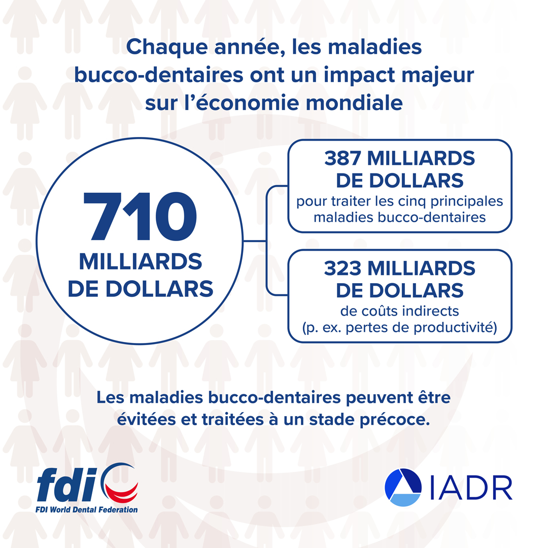 coût du alli