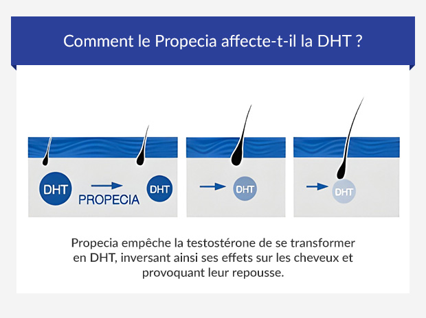 Achat propecia sans ordonnance