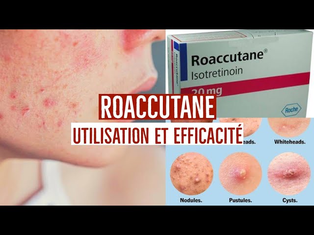 Roaccutane 10 Mg Prix