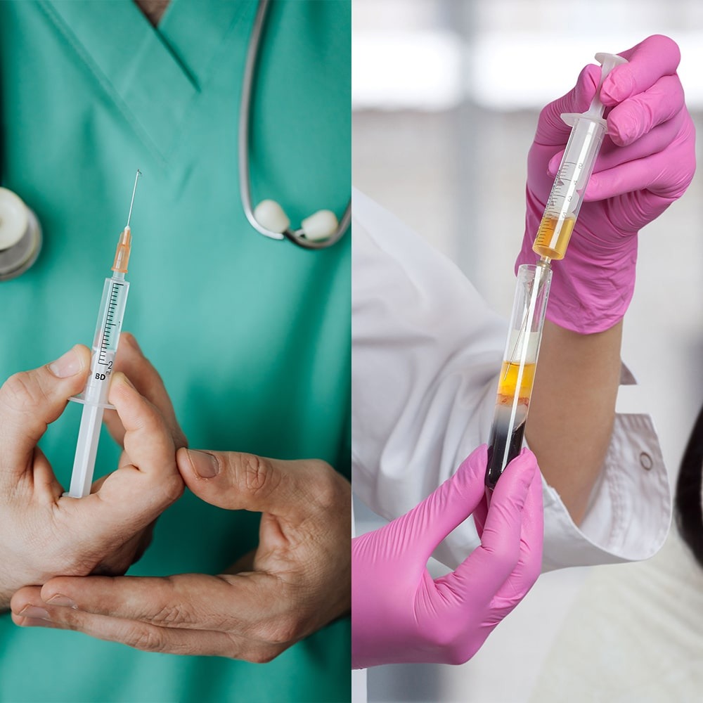Coût Du Prednisolone Coût du prednisolone