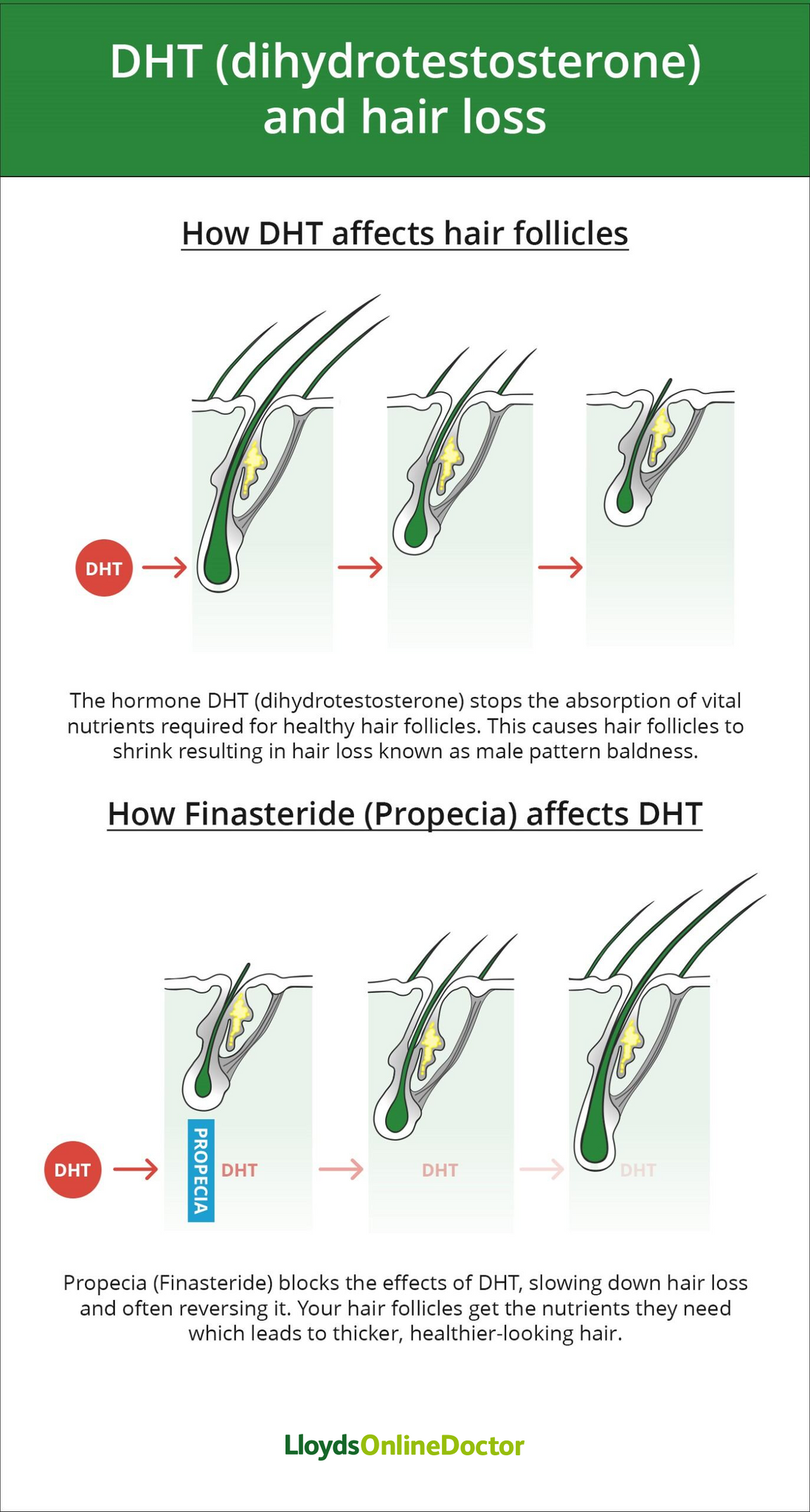finasteride online europe finasteride online europe