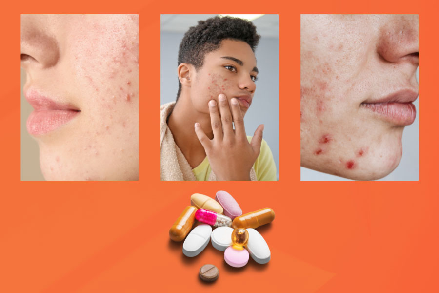 isotretinoin en ligne
