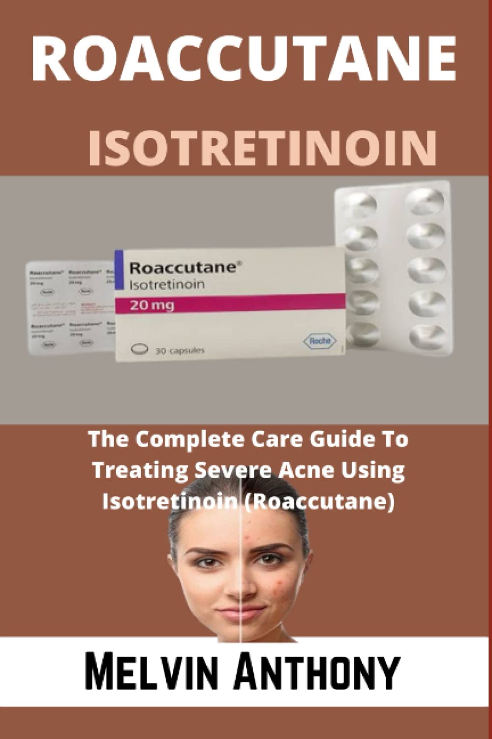 Isotrex france