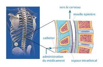 Lioresal en ligne