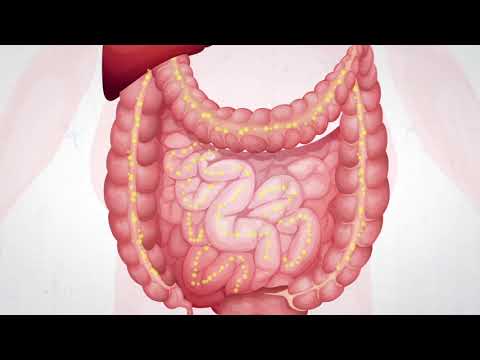 Orlistat Sandoz Generique Orlistat Sandoz Generique
