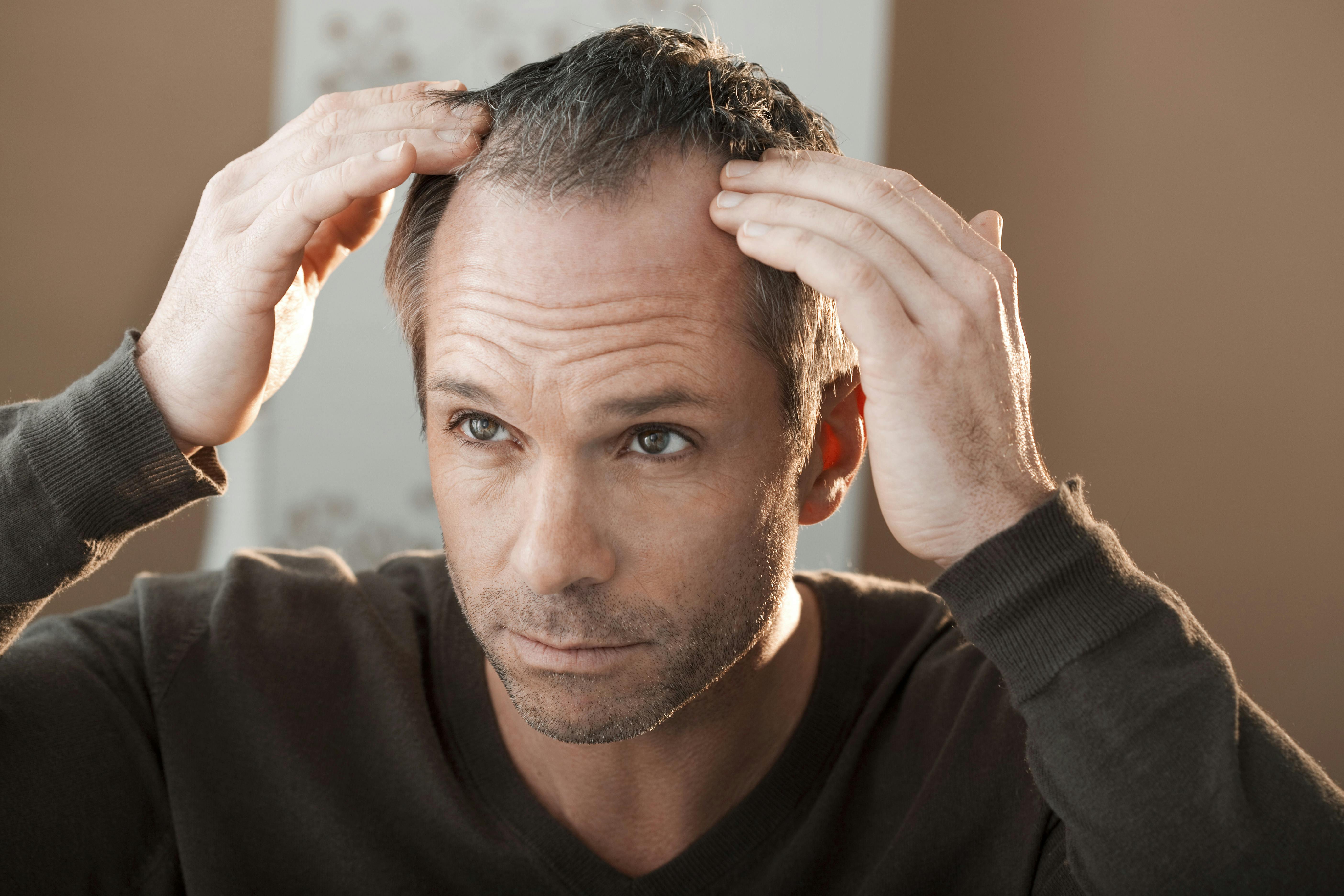 prix finasteride 5mg
