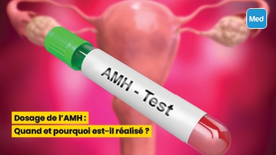 Prix imovane en pharmacie