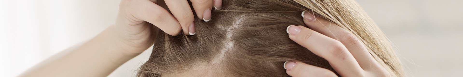 Propecia Cheveux Prix