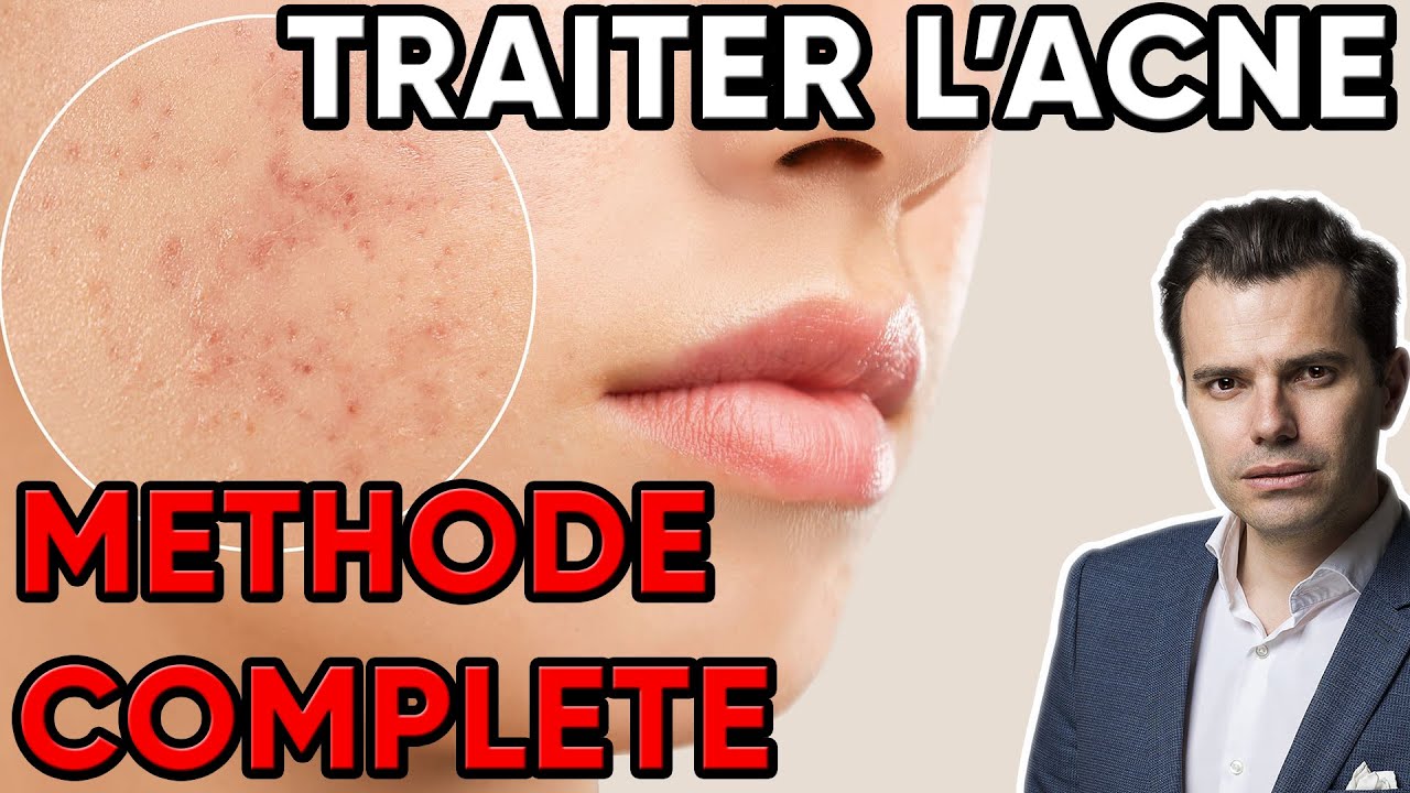 Roaccutane Avec Ou Sans Ordonnance