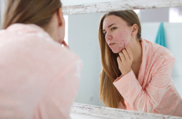 Roaccutane pilule obligatoire