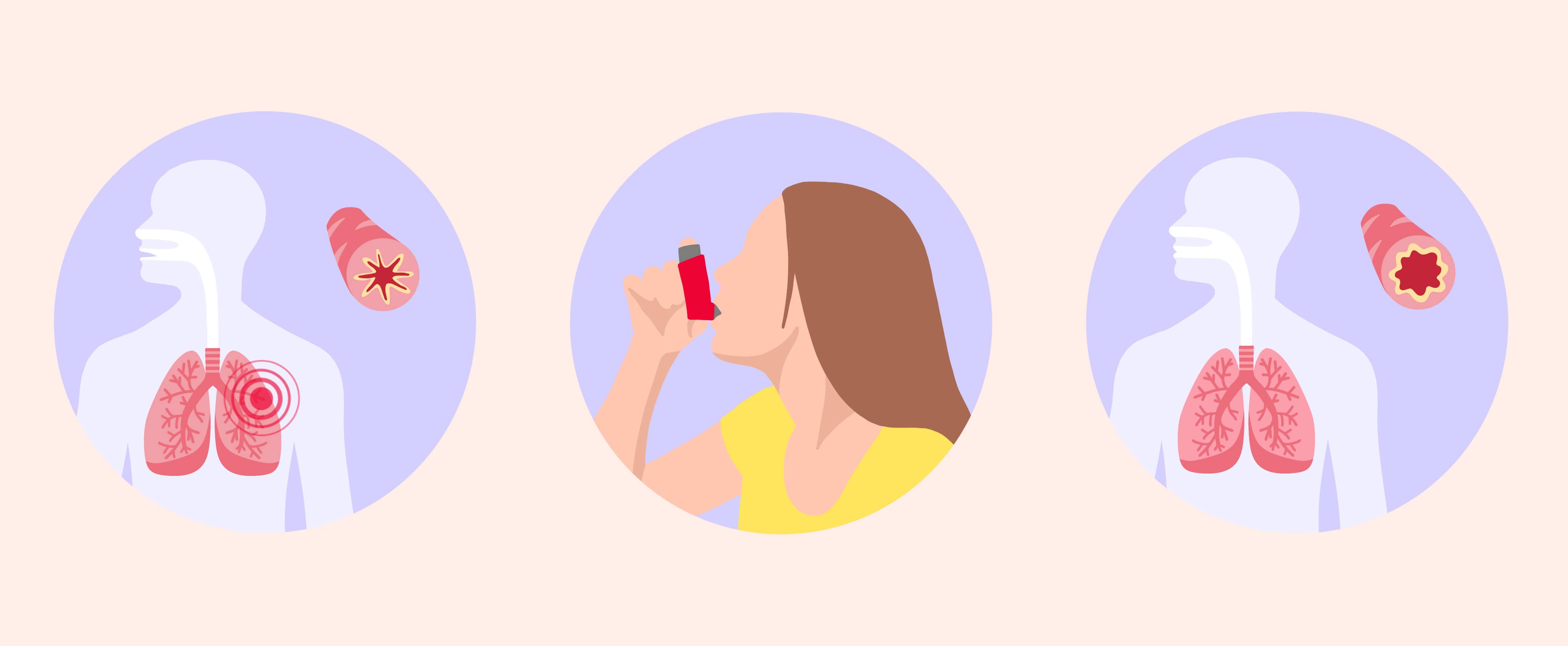 Salbutamol en ligne